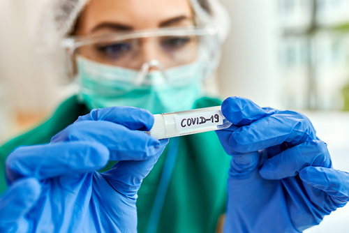 Latest company news about COVID: Czy powinniśmy obawiać się nowej zimnej fali zakażeń?
