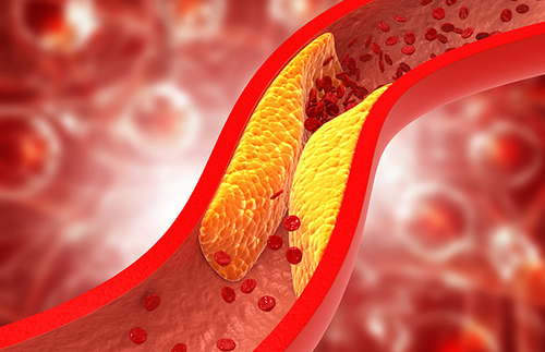 Najnowsze wiadomości o Rozszyfrowanie cholesterolu: droga do zdrowego ciała