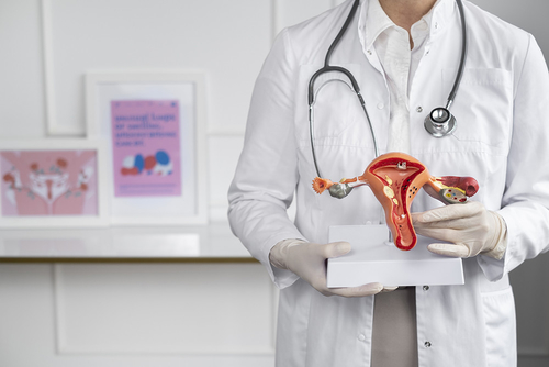 Najnowsze wiadomości o Endometrioza silnie wiąże się ze zwiększonym ryzykiem raka jajnika