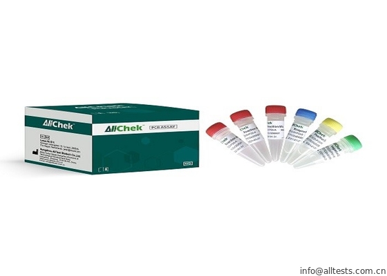 Good price SARS-COV-2 Test RT-QPCR Metoda potrójnej fluorescencji RT-PCR w Internecie